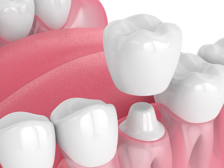 Michael J. Murray, DDS